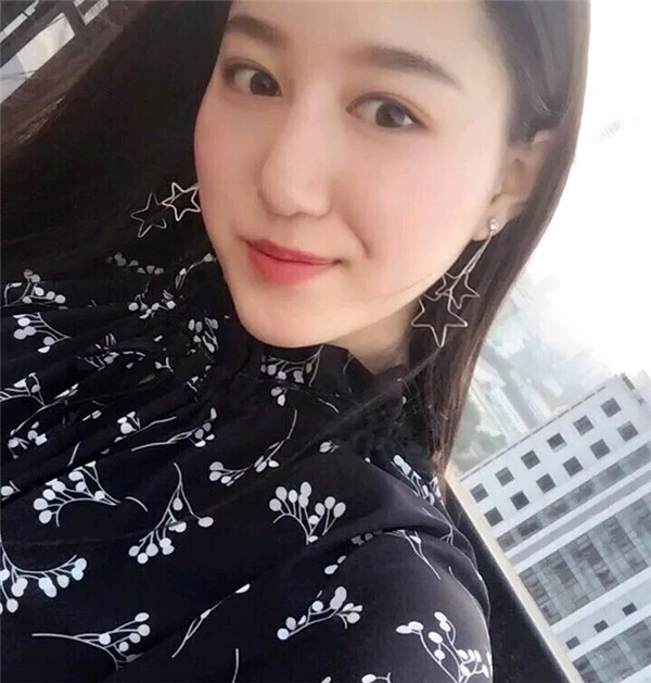 小仙女儿的鼻部手术案例分享连载（三）