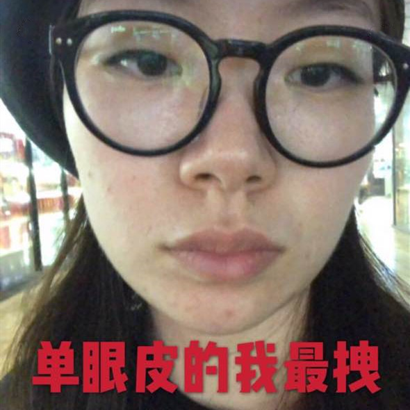 深圳美莱做双眼皮怎么样？美莱做的微创双眼皮