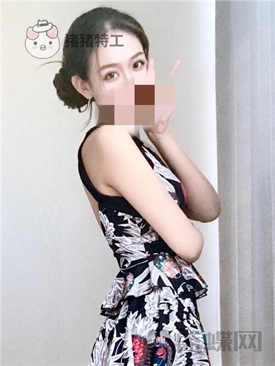 杭州美莱韩超双眼皮案例价格分享，做个双眼皮朋友以为我去换了个头？？