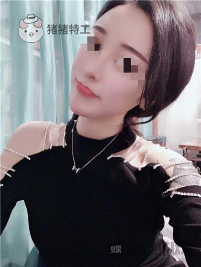 上海华美李庭勋隆鼻案例价格分享，这张混血脸你招架得住吗？