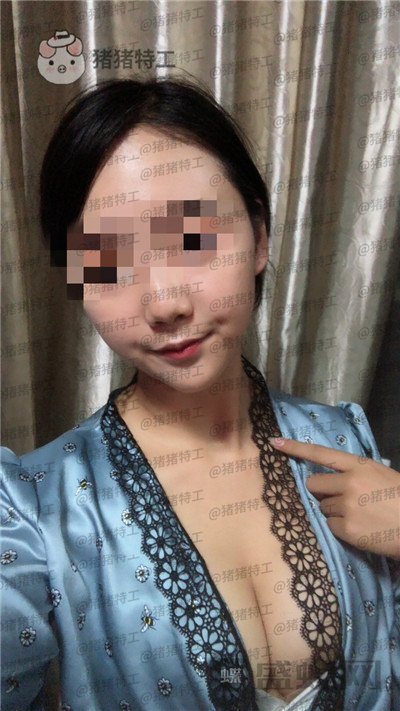 南京美贝尔黄名斗​隆胸案例价格分享，感觉自己都备注自己诱惑到了~~