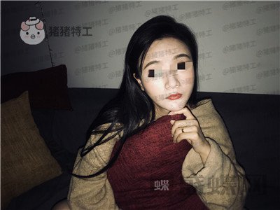 上海华美李志海下颌角整形案例价格分享，这张脸改变了我的整个人生轨道~