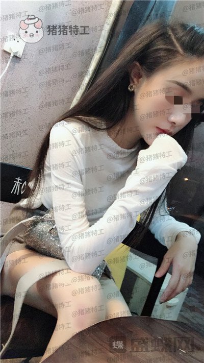 上海华美李志海下颌角整形案例价格分享，这张脸改变了我的整个人生轨道~