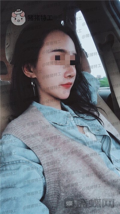 上海华美李志海下颌角整形案例价格分享，这张脸改变了我的整个人生轨道~