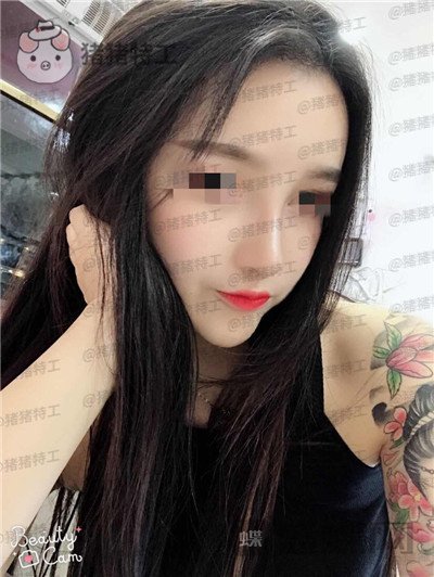 重庆华美蒋琳​隆鼻案例价格分享，仙女隆鼻之后是一种是什么体验？