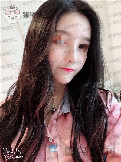 重庆华美蒋琳​隆鼻案例价格分享，仙女隆鼻之后是一种是什么体验？