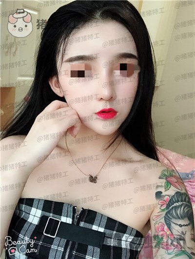 重庆华美蒋琳​隆鼻案例价格分享，仙女隆鼻之后是一种是什么体验？