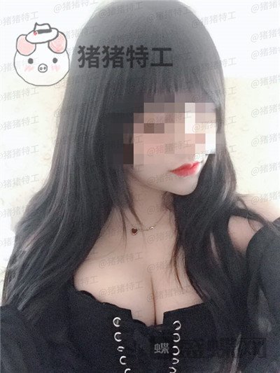 南京美贝尔黄名斗隆胸案例价格分享，穿上伴娘服的我被自己美到了！