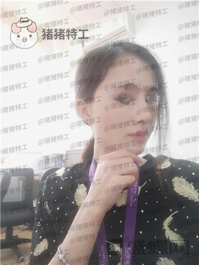 长沙美莱斌鼻部手术案例价格分享，存了好久的钱换来这个鼻子大家帮我看看~