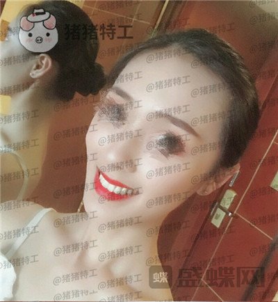 成都博爱李竞男牙齿美白案例价格分享，黄牙妹做完张口大笑再也不自卑~