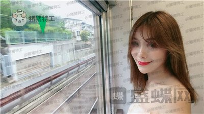 北京百达丽上海九院硕士苏婷隆鼻修复案例价格分享，因为是模特所以对鼻子要求很高。