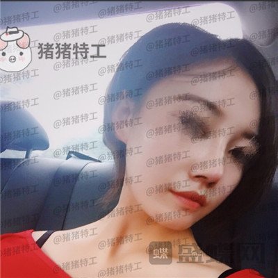 苏州美莱吴蓉鼻部手术案例价格分享，隆鼻一时爽一直美丽一直爽~