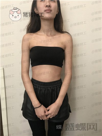 南京美贝尔黄名斗隆胸案例价格分享，变身性感女神婚后生活真美好~