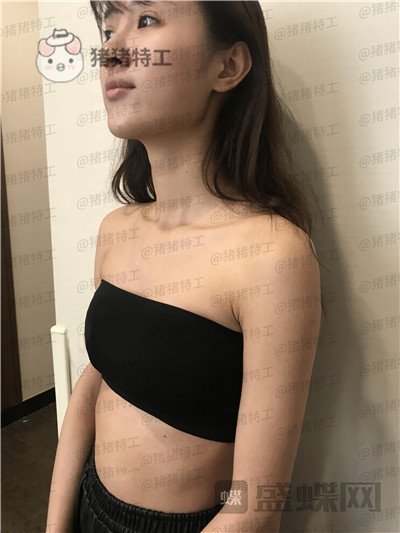 南京美贝尔黄名斗隆胸案例价格分享，变身性感女神婚后生活真美好~