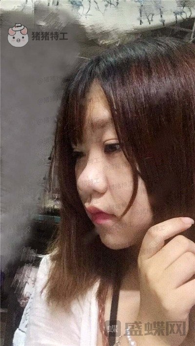 重庆玺悦台蒋福明面部吸脂案例价格分享，像娃娃一样的美少女你见过吗？