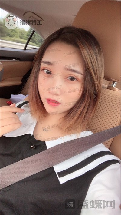 杭州格莱美王馨婉双眼皮案例价格分享，很可爱的眼睛真的好感度倍增~