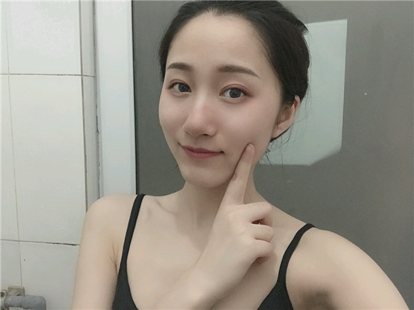 重庆好美李曾显双眼皮怎么样？价格案例