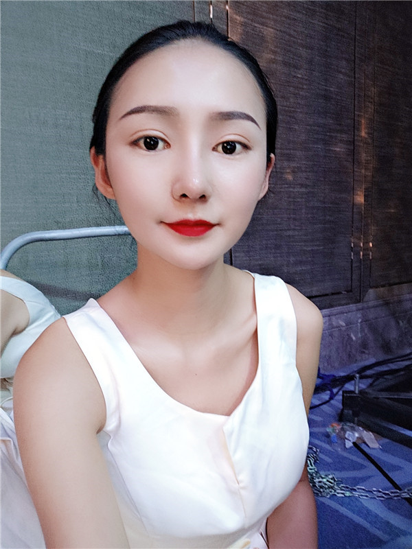 云南华美美莱李韬双眼皮怎么样？价格案例