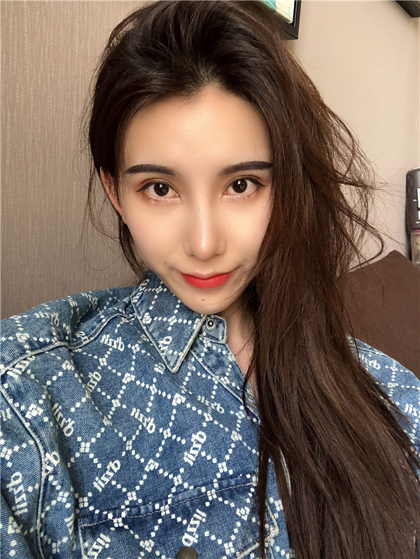 云南华美美莱隆鼻怎么样？价格案例31天